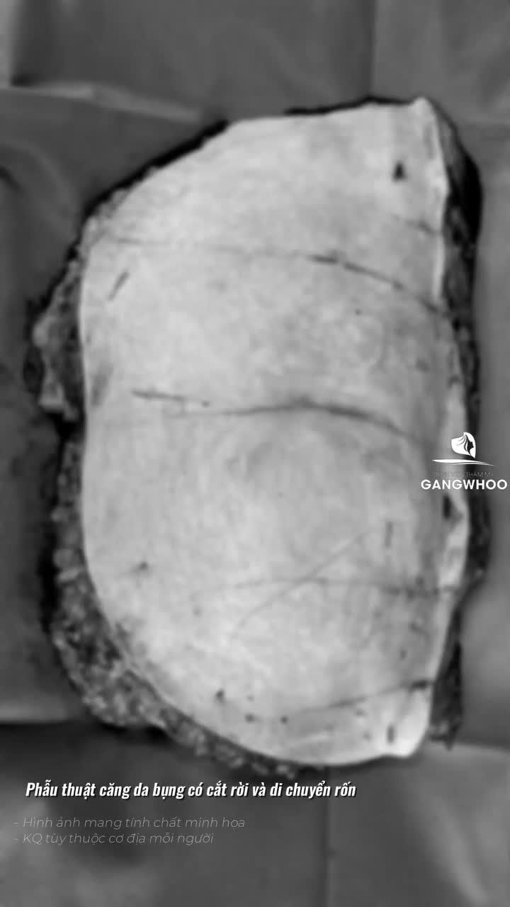 Bác sĩ khám cho một khách hàng nữ người Úc sau khi thực hiện điều trị bụng.