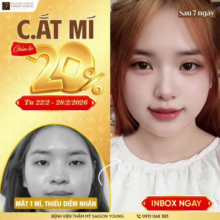 Lộc xuân trao tay - Cắt mí, nhấn mí GIẢM 20%