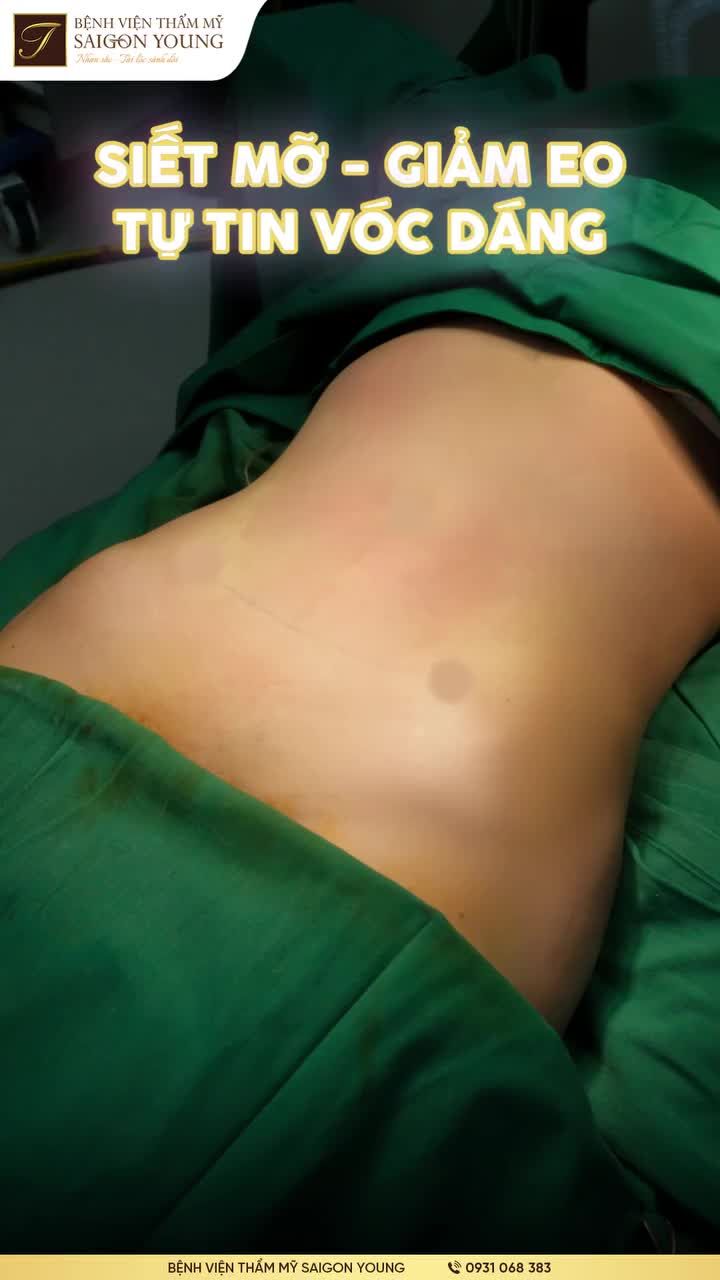 Hủy mỡ bụng giúp nàng tái định nghĩa vóc dáng