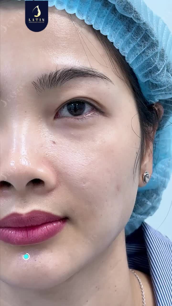 CẬN CẢNH CA MÍ SỬA LẠI NÓNG HỒI MỚI RA LÒ