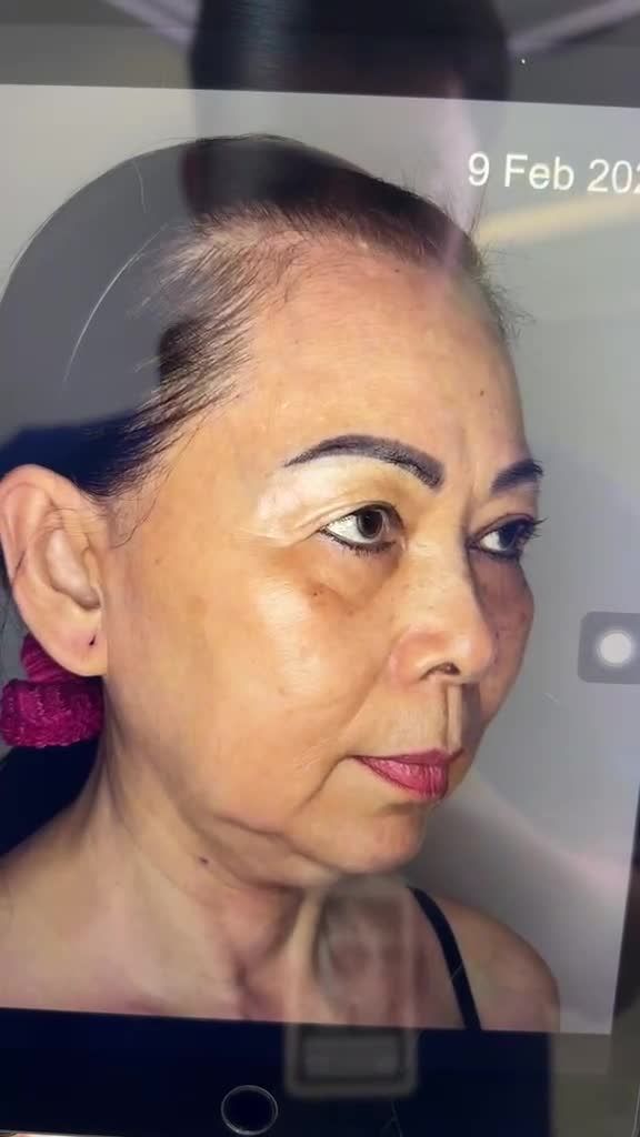 Bác sĩ Tú Dung bất ngờ với diện mạo TRẺ 20 TUỔI của U70 Việt kiều mỹ sau 10 ngày thực hiện COMBO CẢI LÃO tại JW