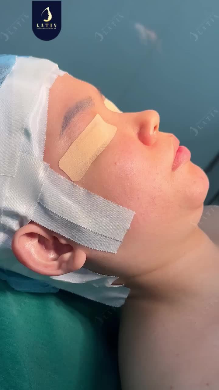 CÓ AI TỪNG NÉ GÓC CHỤP VÌ DÁNG MŨI THẤP BÈ?