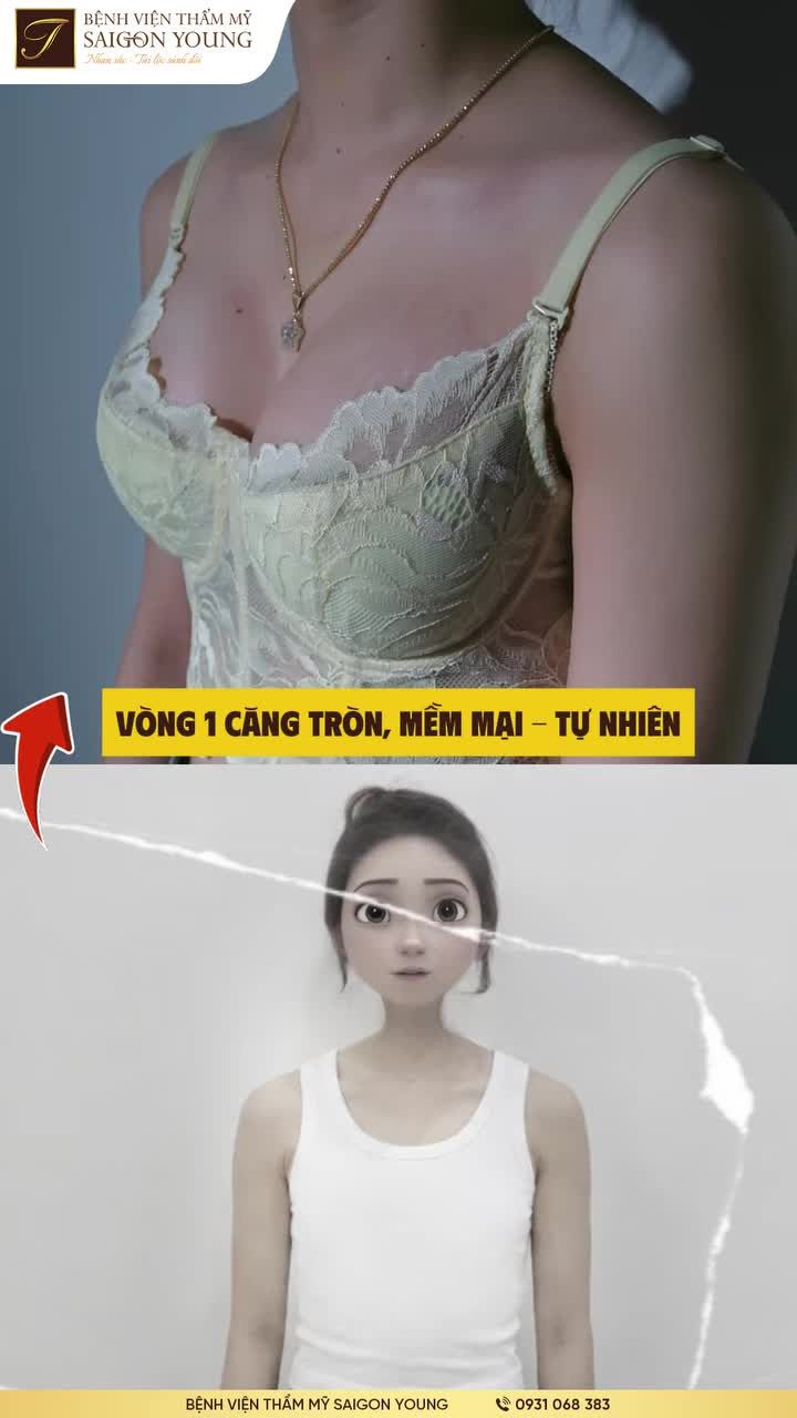 Tiêu chuẩn vàng cho vòng 1 được kiến tạo bởi BVTM Saigon Young là tổng hòa của nét tinh tế mà khách hàng nhận được: Căng mềm tự nhiên - Sẹo mảnh như tơ - Khai mở tài lộc.