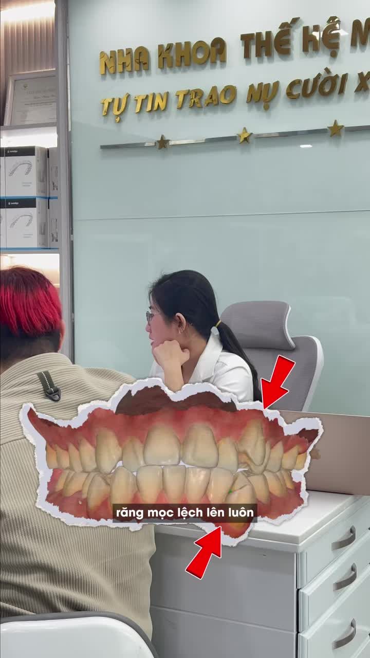 TẠI SAO KHÔNG NHỔ RĂNG NANH ĐỂ ĐẨY NHANH QUÁ TRÌNH NIỀNG RĂNG ??