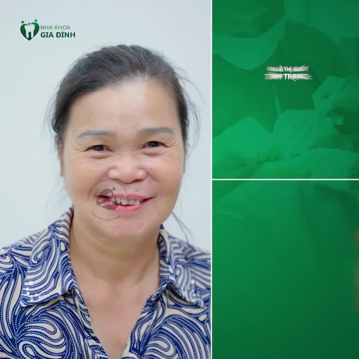 MẤT RĂNG TRONG MỘT THỜI GIAN DÀI, ĐẾN HÔM NAY CÔ SUỐT MỚI CÓ THỂ ĂN NHAI NGON MIỆNG TRỞ LẠI