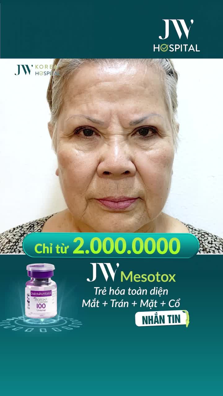 TRẺ HOÁ KHÔNG PHẪU THUẬT CHO U50-U80 HẾT NHĂN NHEO, TRẺ 10 TUỔI VỚI MESOTOX TẠI JW