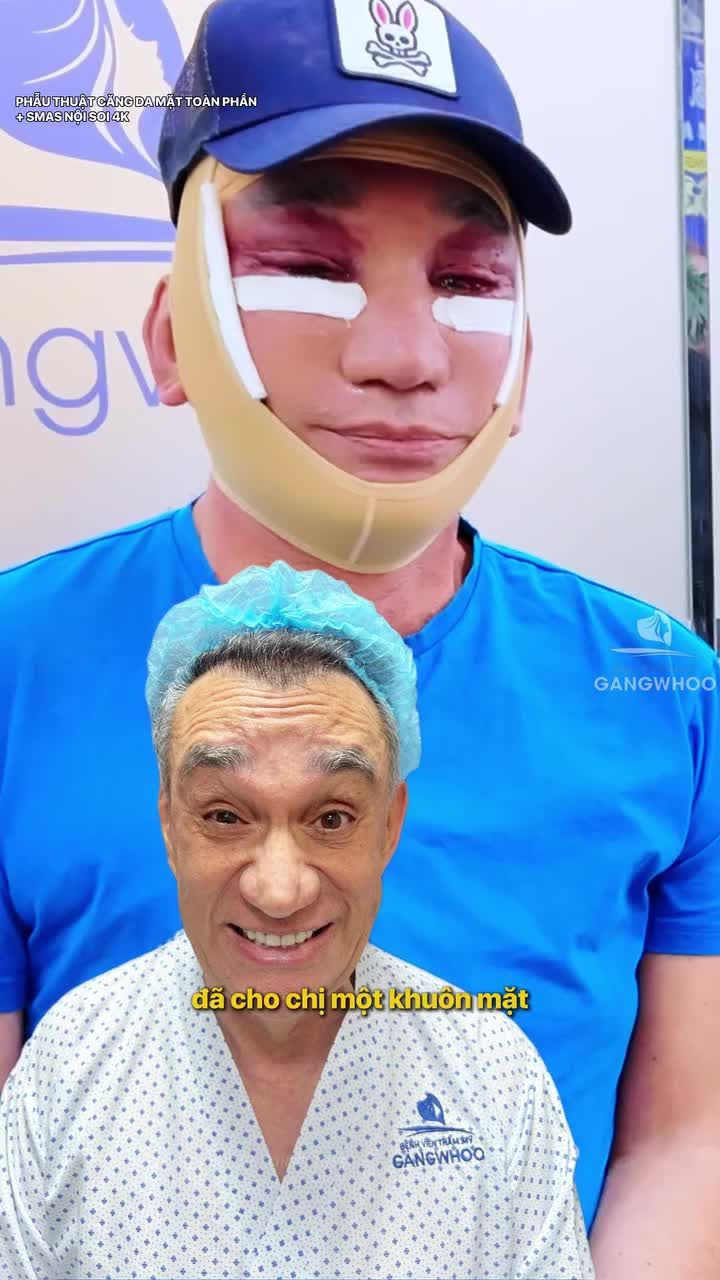 Vợ chồng Mỹ tìm diện mạo mới với phẫu thuật căng da mặt toàn phần + Smas nội soi 4K tại Bệnh viện thẩm mỹ Gangwhoo