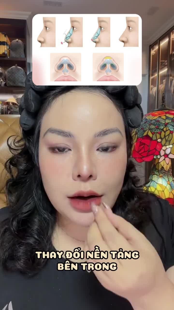 Da mũi mỏng thì nên làm phương pháp gì?