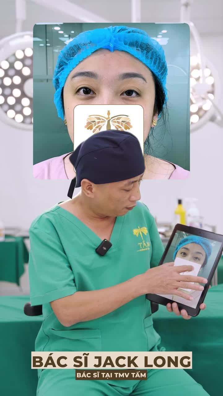 Mắt đa nếp mí, cơ nâng mi yếu – ca khó nhưng không hiếm gặp Cùng bác sĩ Jack Long phân tích và xử lý trường hợp thực tế này nhé!