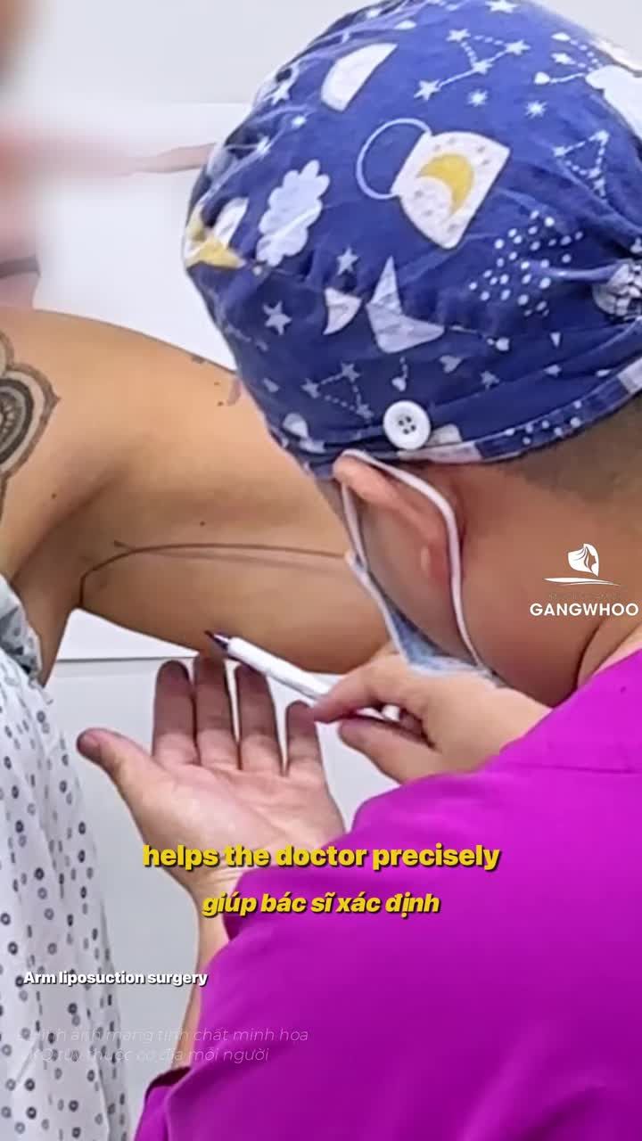 Khách Quốc tế Úc sau 1 tuần giảm mỡ bắp tay tại Gangwhoo.