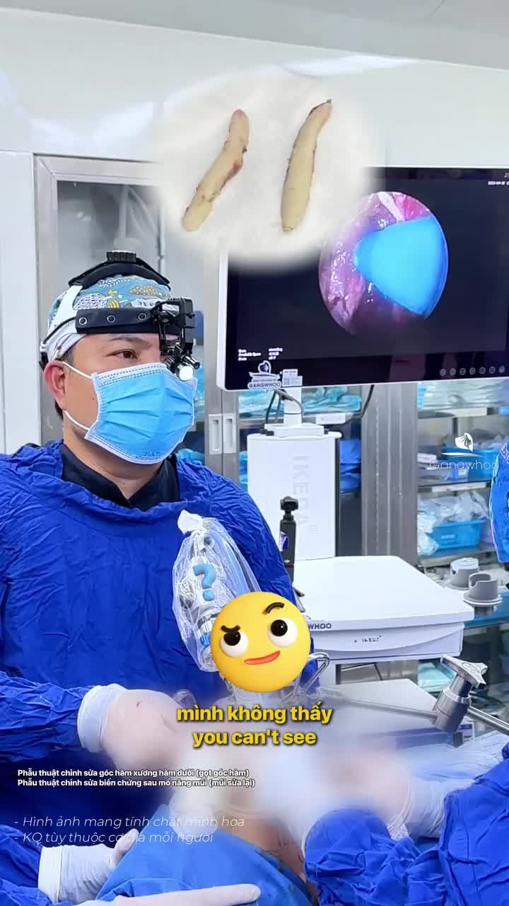 Ứng dụng công nghệ nội soi trong gọt hàm sẽ giúp quá trình hồi phục của khách hàng diễn ra nhẹ nhàng, hạn chế sưng bầm và hồi phục nhanh chóng.