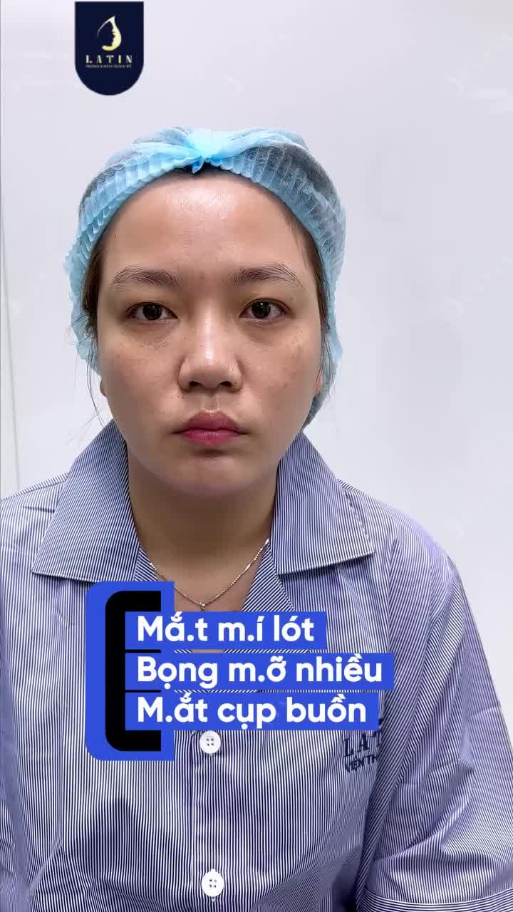 THAY ĐỔI NHỎ Ở ĐÔI MẮT - THAY ĐỔI LỚN Ở THẦN THÁI