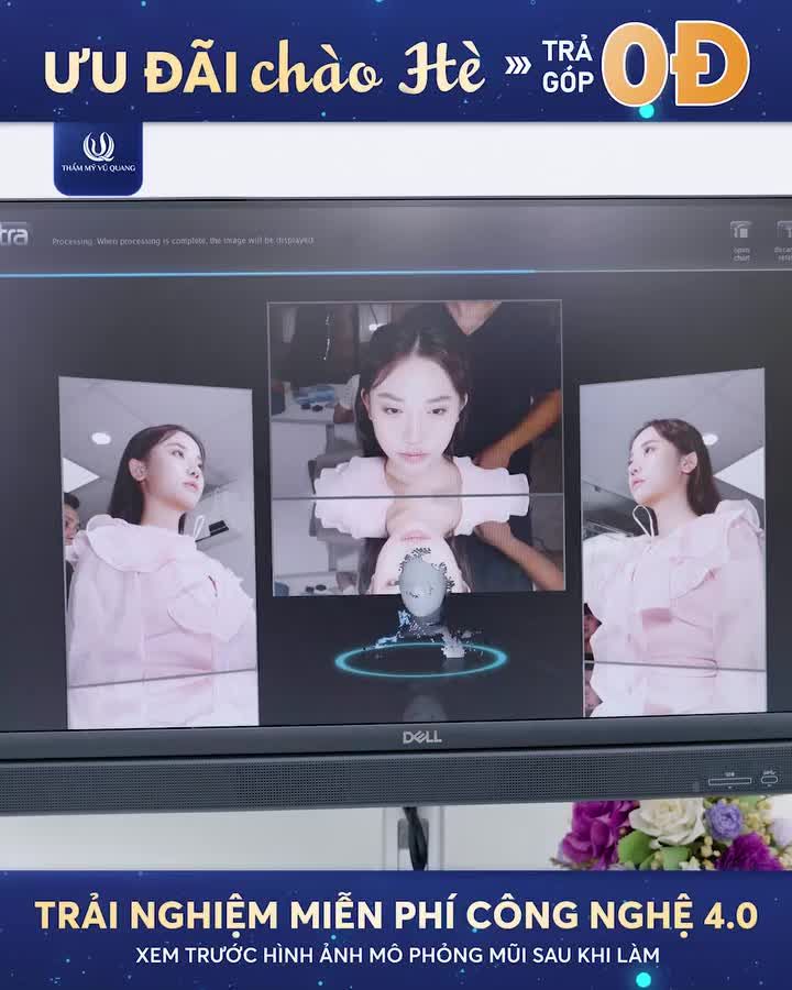 Bạn đã bao giờ tự hỏi: Sau khi nâng mũi, gương mặt của mình sẽ thay đổi như thế nào?