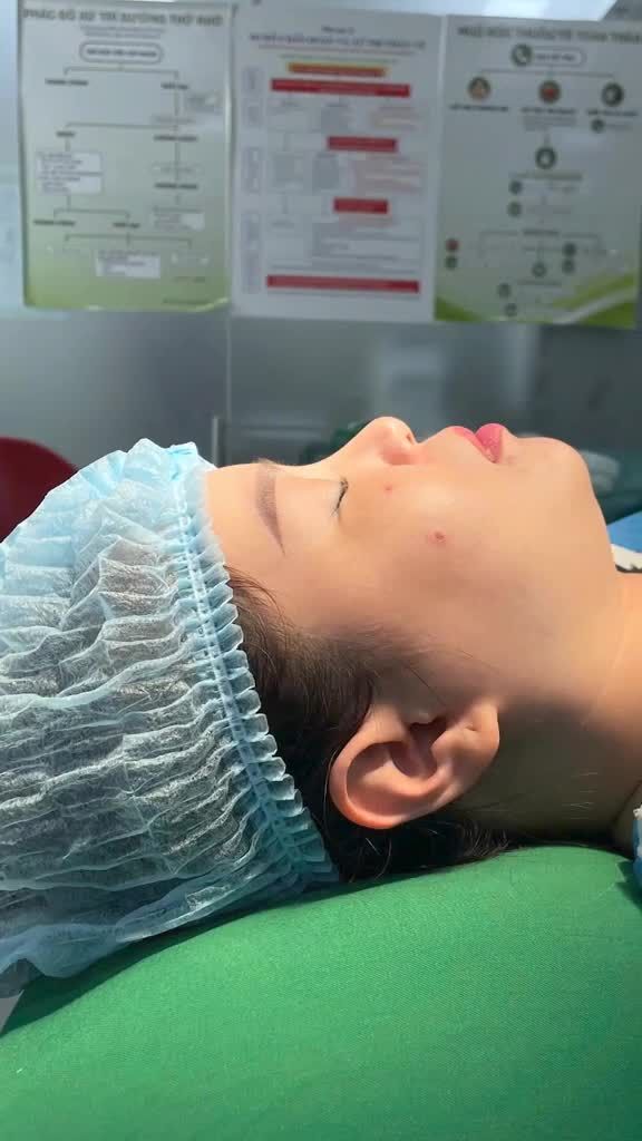 Chất liệu nào phù hợp với dáng mũi cần tái tạo lại?