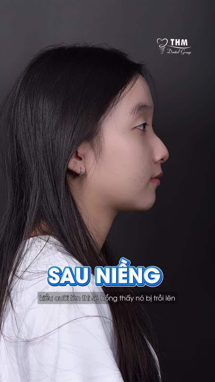 Chắc hẳn đây là khoảnh khắc rất nhiều đồng niềng mong chờ đúng không?