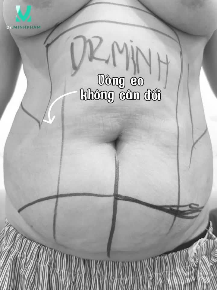 MỘT LẦN CHẠM – NÂNG HẠNG NHAN SẮC