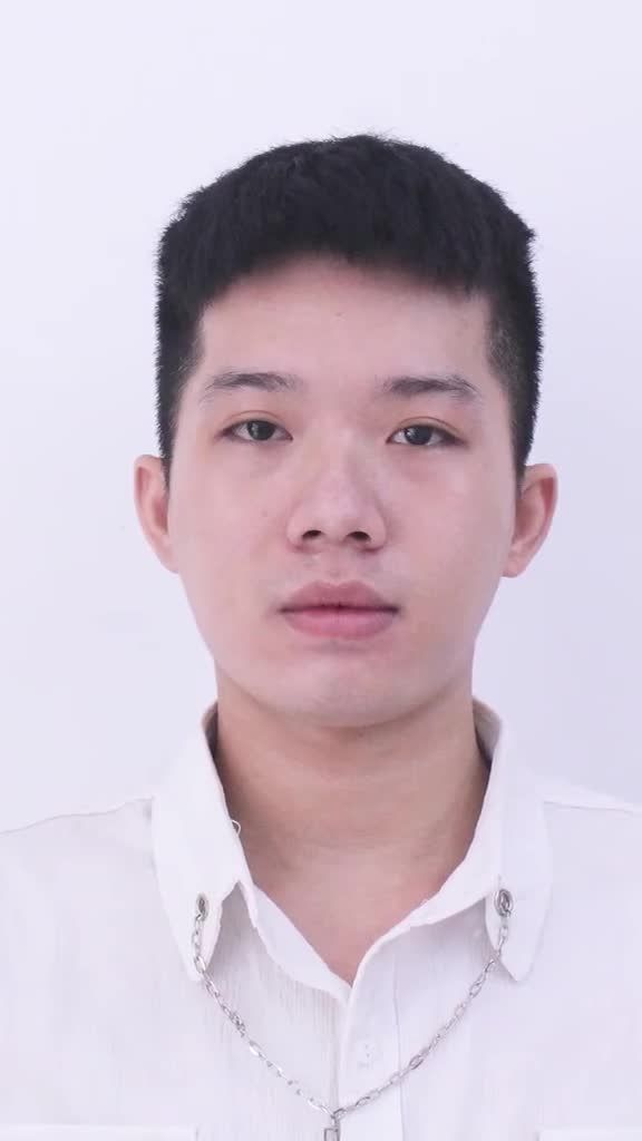 KH Nam thực hiện combo Nâng mũi + Độn cằm!