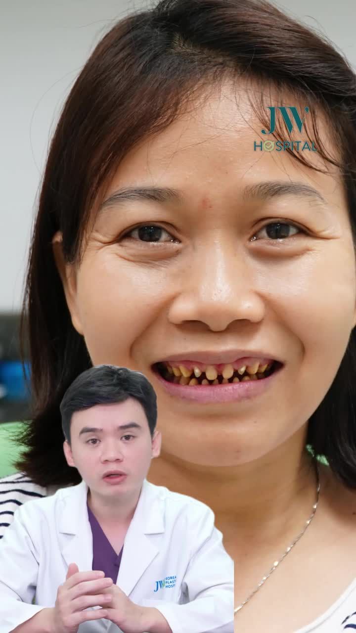 KINH HOÀNG: U60 BỊ MÀI NÁT RĂNG VÌ BÁC SĨ DỎM, TÁI SINH NỤ CƯỜI TỰ TIN VỚI RĂNG SỨ KIM CƯƠNG TẠI JW