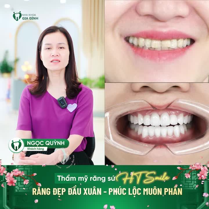RĂNG ĐẸP ĐẦU XUÂN - PHÚC LỘC MUÔN PHẦN