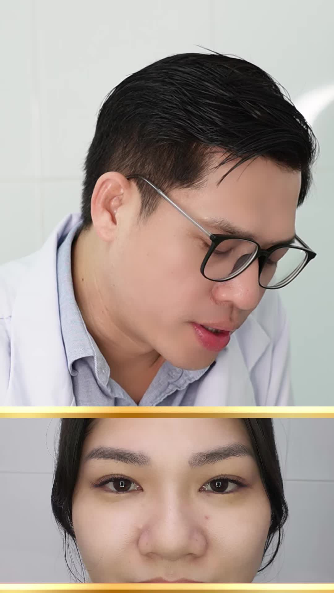 Xem đến cuối để biết kết quả của chiếc mũi này!