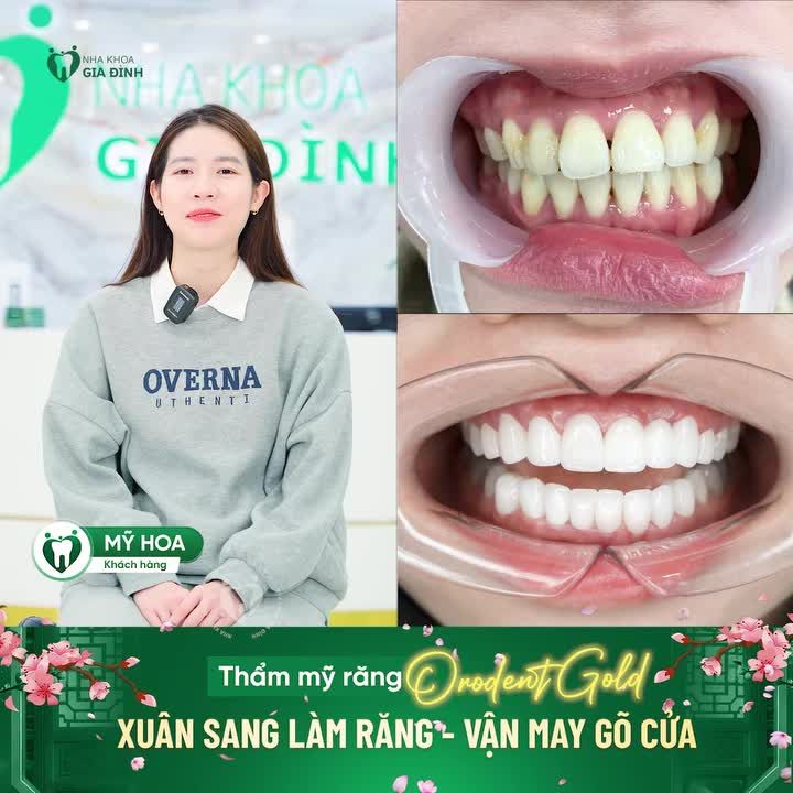 Xuân sang mang theo khởi đầu mới, và không gì tuyệt vời hơn khi bạn bắt đầu năm mới với một nụ cười rạng rỡ, tự tin.