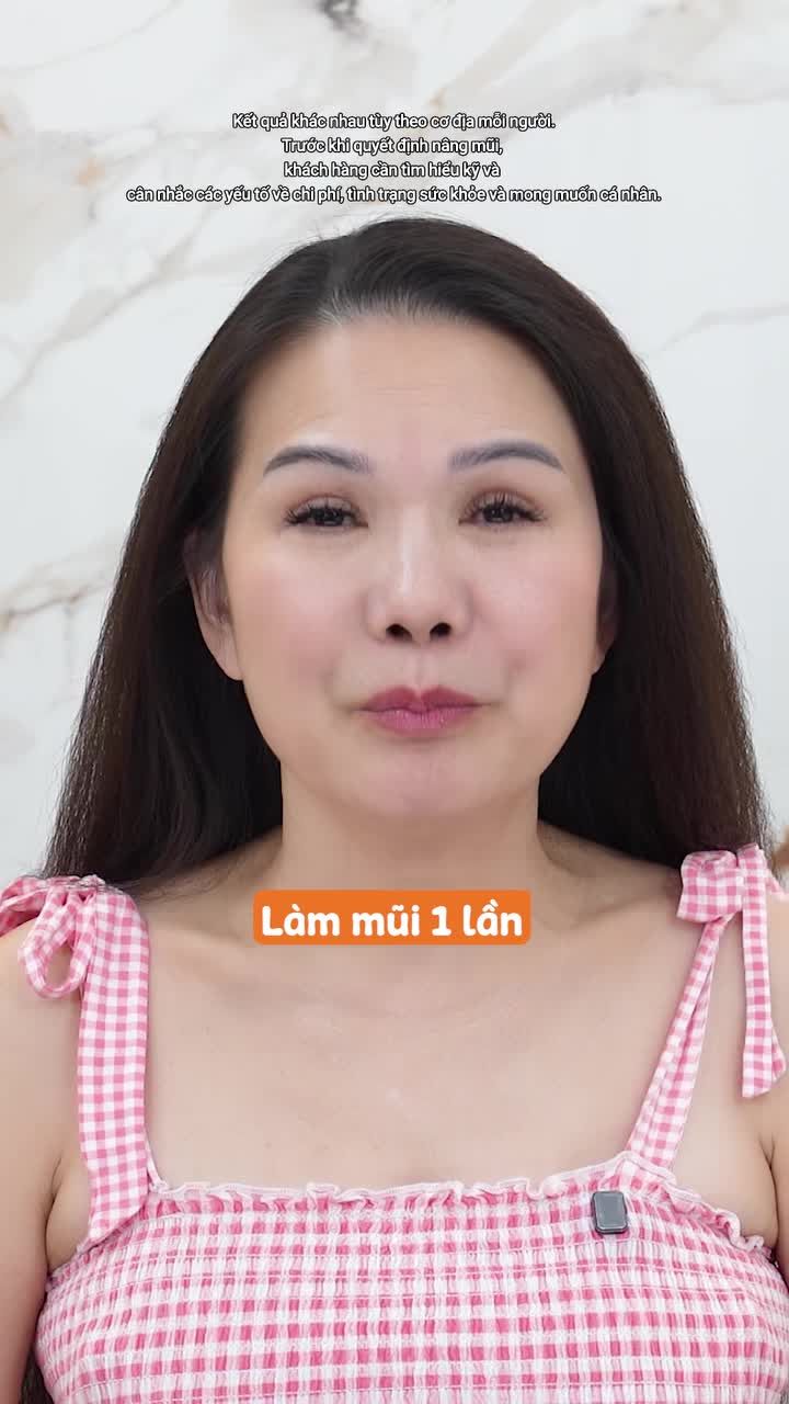 Cải thiện tình trạng ngắn hếch cho Việt Kiều Mỹ - Ca sĩ Quách Phụng Anh sau 35 năm nâng mũi nhân tạo.