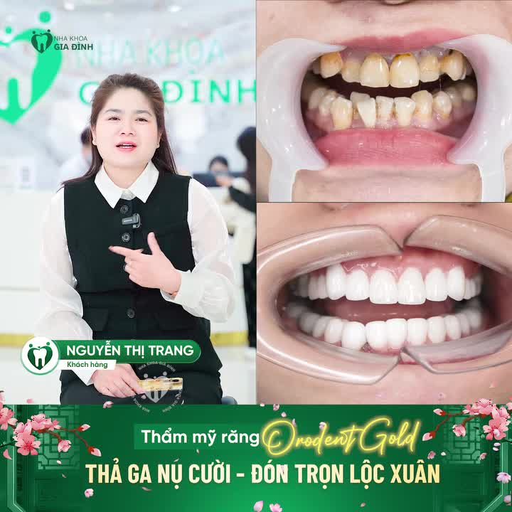 THẢ GA NỤ CƯỜI - ĐÓN TRỌN LỘC XUÂN