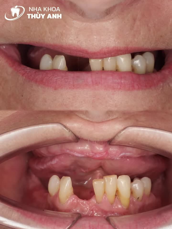 ''Tôi không thể tiếp tục sống với hàm răng này nữa!''