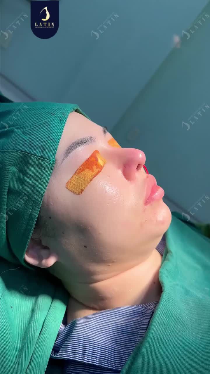 ĐẮN ĐO 2 NĂM SỬA TRONG 2 GIỜ