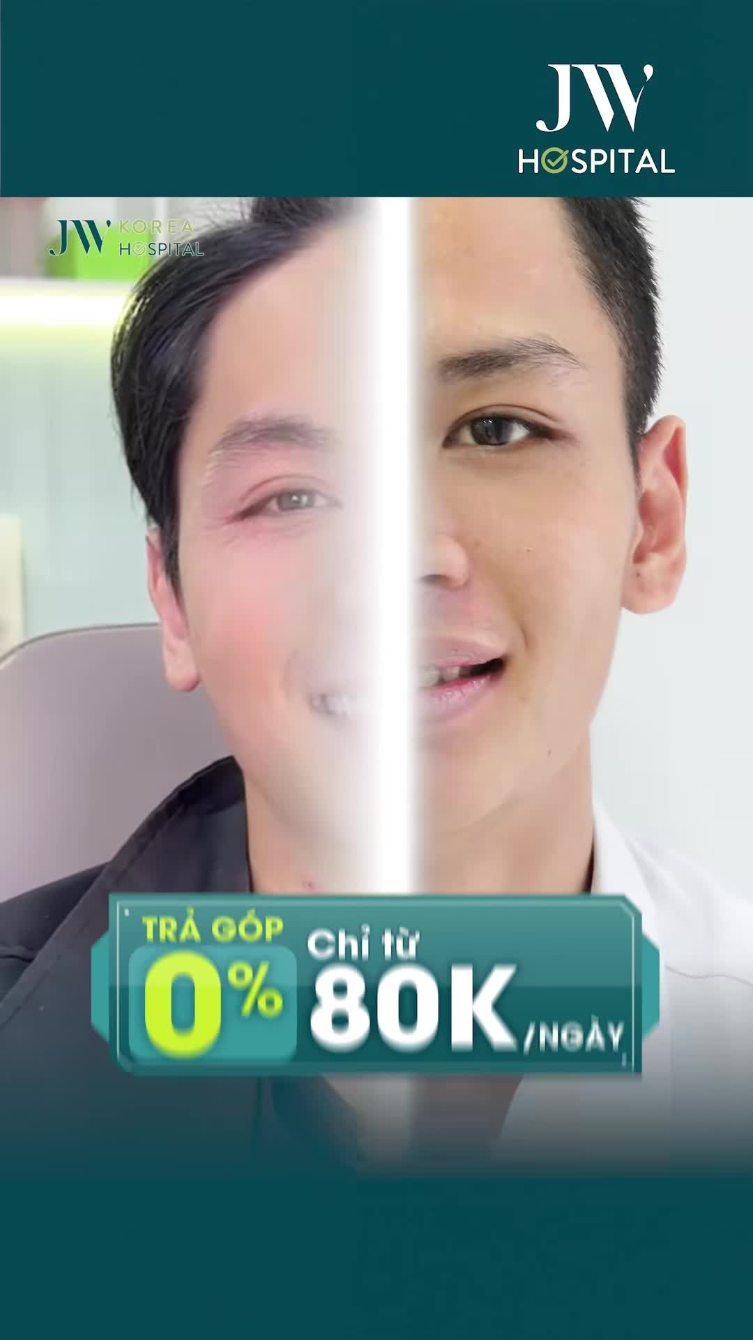 TOP 3 CÔNG NGHỆ NIỀNG RĂNG SMART AI - ĐỔI NỤ CƯỜI SÁNG TƯƠNG LAI