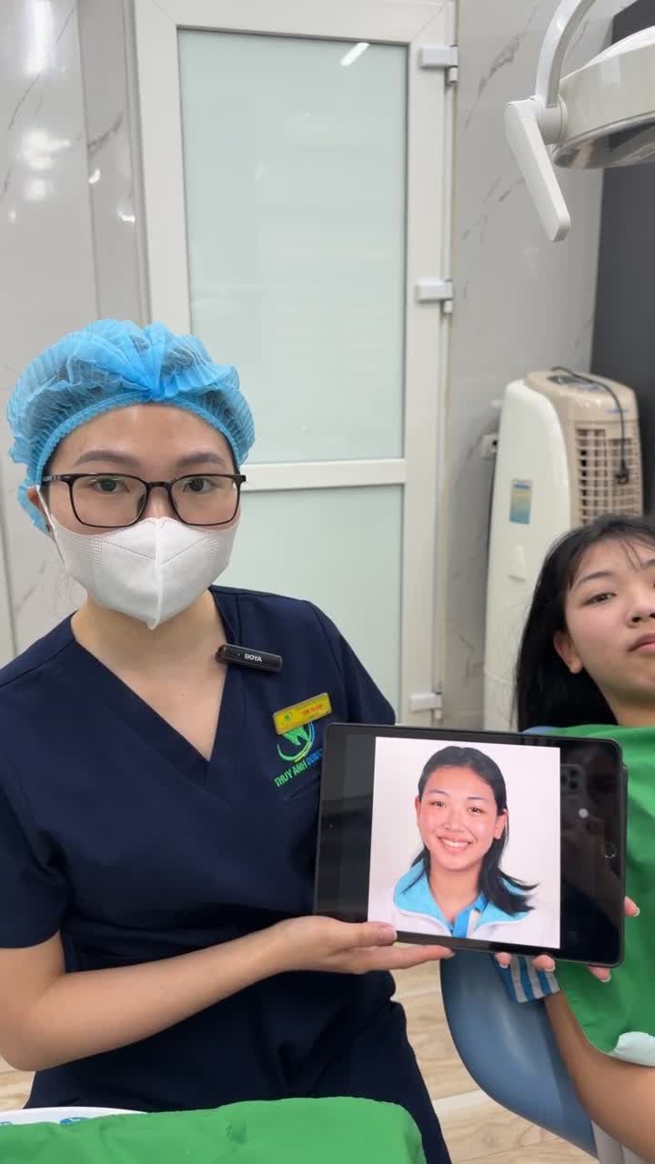 Cận cảnh quá trình gắn mắc cài niềng răng, khắc phục tình trạng răng hô cho bạn Thanh Ngọc.