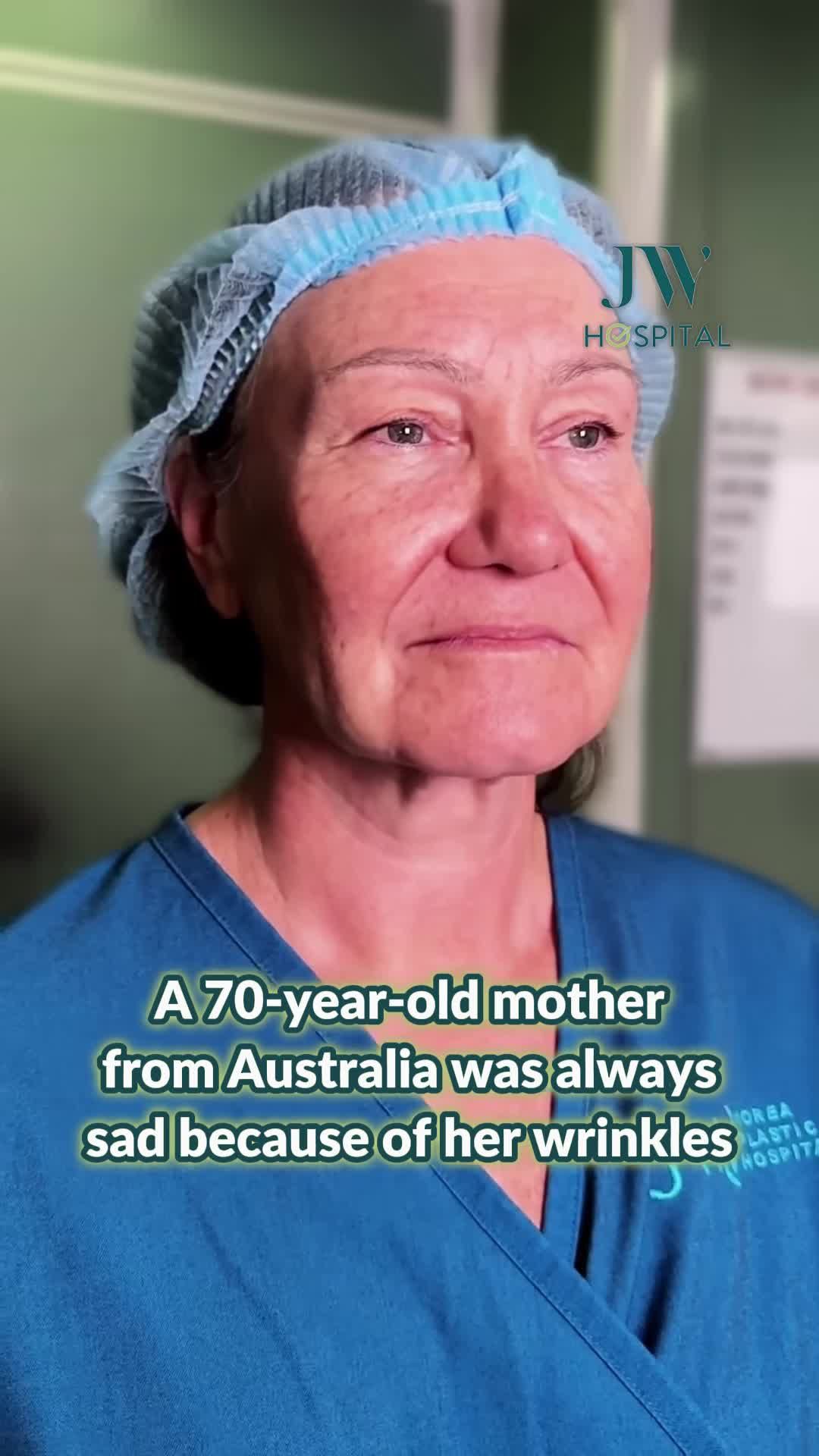 BIẾN HÌNH TUYỆT VỜI: QUÝ CÔ ÚC TRẺ RA 20 TUỔI SAU SMAS PRO FACELIFT