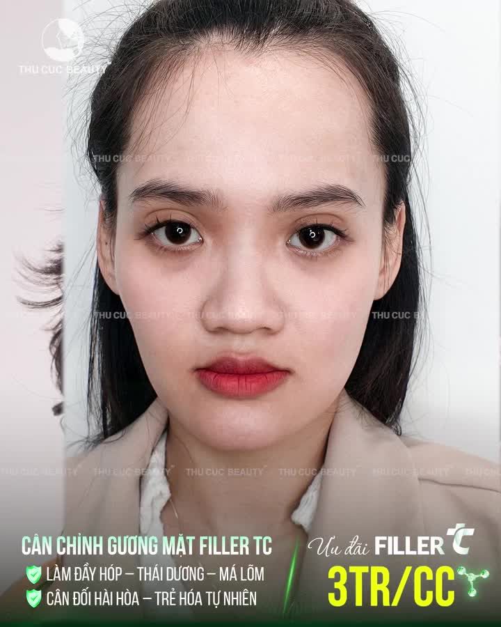 Lõm đâu – đầy đó Hóp đâu – chỉnh đó