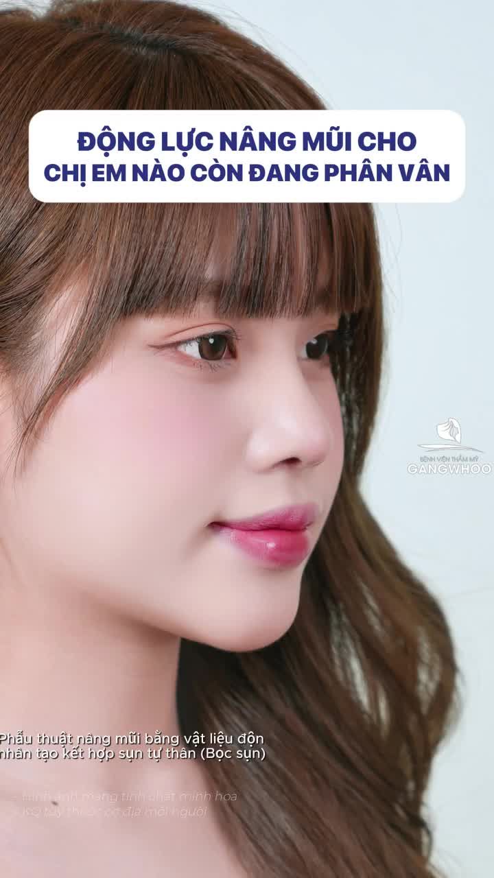 Động lực nâng mũi cho chị em nào còn đang phân vân