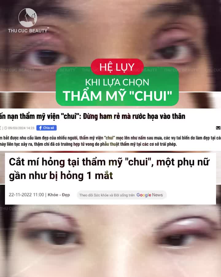 Viêm nhiễm dai dẳng do lựa chọn THẨM MỸ "CHUI"