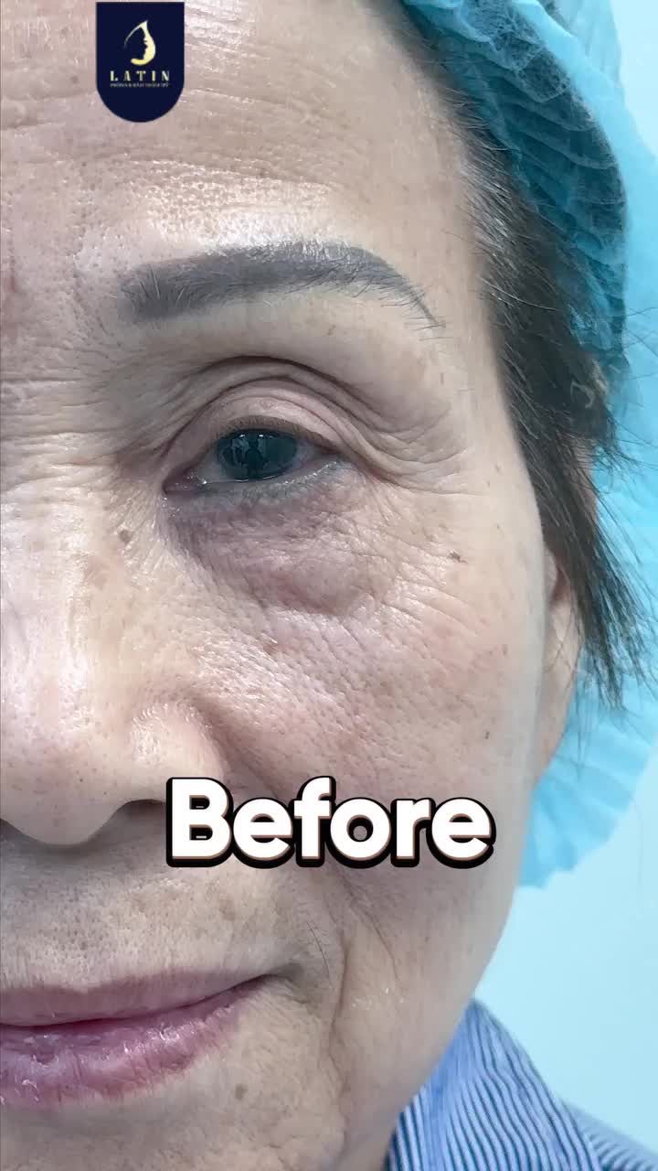 KHOẢNG CÁCH 20 NĂM TUỔI THU NGẮN LẠI CHỈ SAU 1 TIẾNG