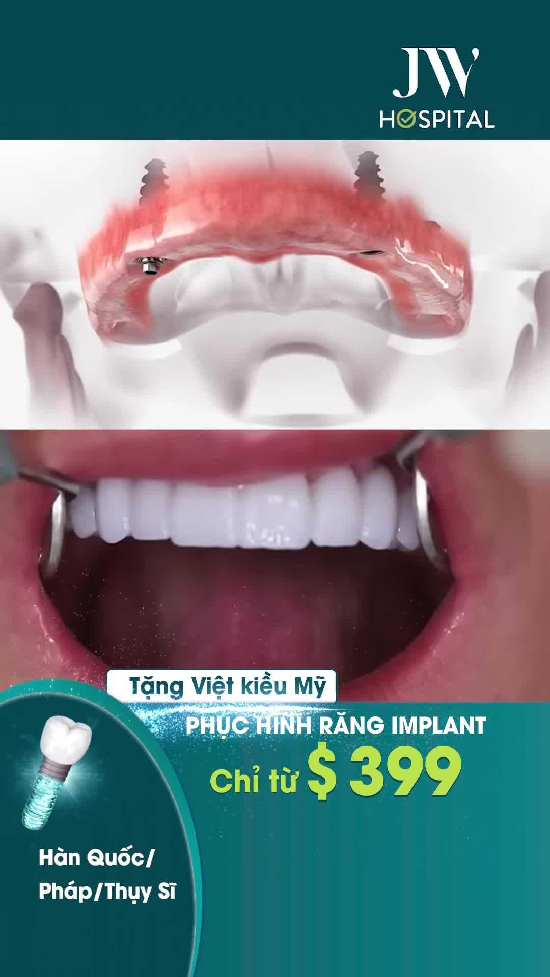 TẶNG VIỆT KIỀU MỸ: PHỤC HÌNH RĂNG IMPLANT TRỌN GÓI TỪ $399 - HOÀN PHÍ MÁY BAY