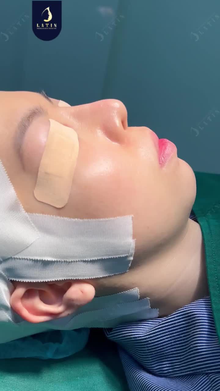 SỰ KHÁCH BIỆT NẰM Ở GÓC NGHIÊNG