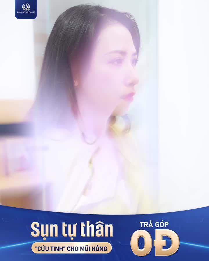 SỤN TỰ THÂN – GIẢI PHÁP "VÀNG" TRONG TÁI TẠO MŨI HỎNG