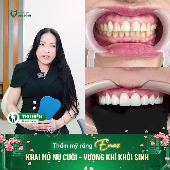 THAY ĐỔI NỤ CƯỜI - VẬN KHÍ KHỞI SINH