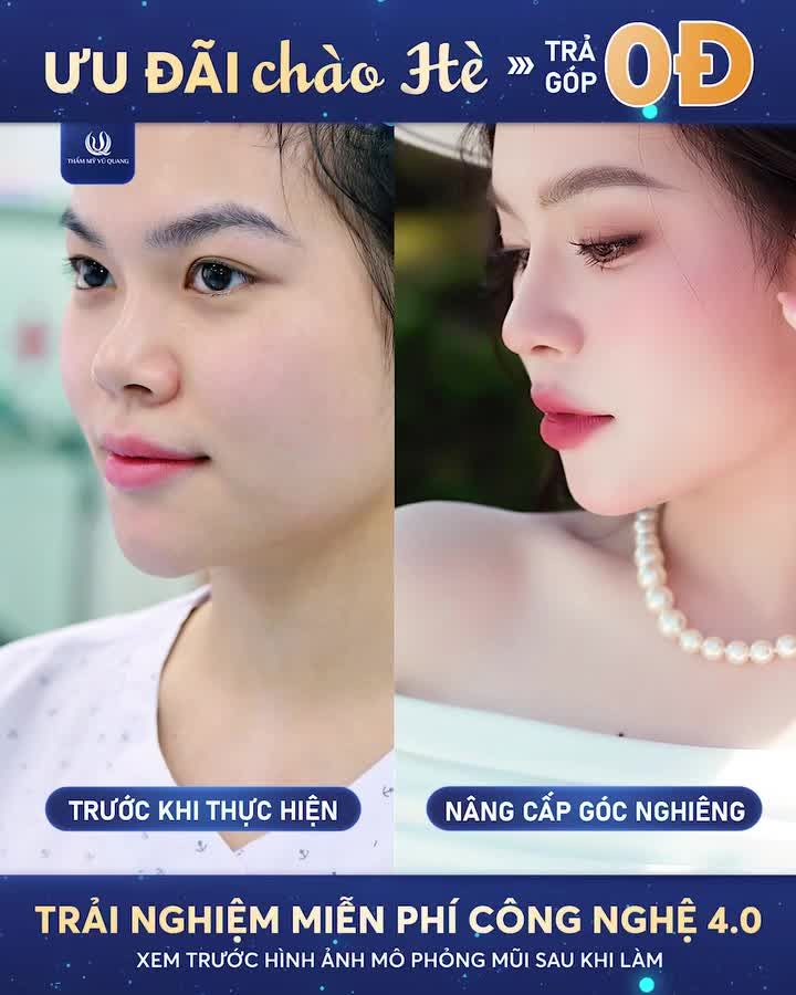 CHÀO HÈ 2026: RẠNG RỠ NHAN SẮC - KHÔNG LO CHI PHÍ!