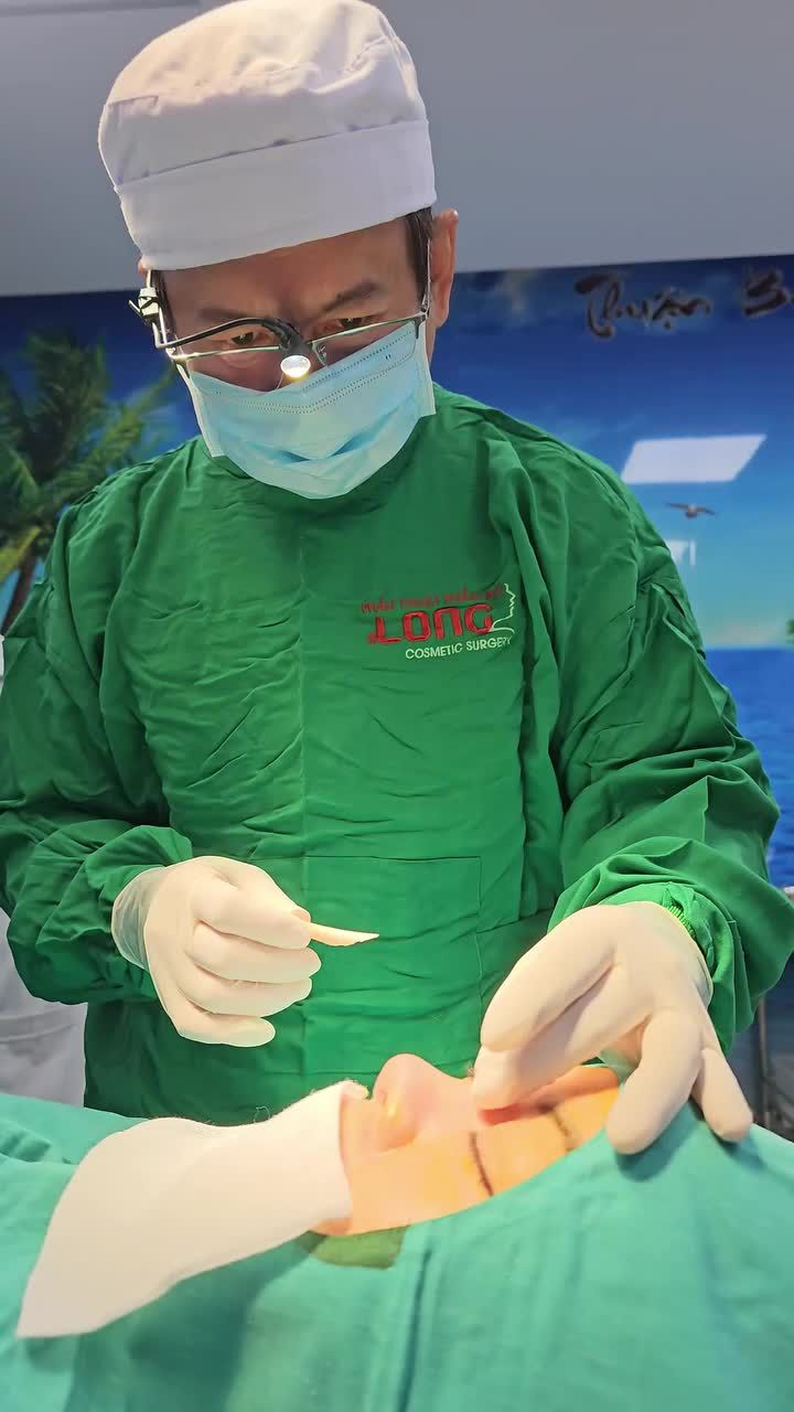 Mũi đã nâng 1–2 năm bỗng dưng sưng, đau, lệch form? Đừng chủ quan…