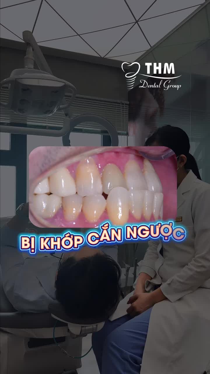 Bị khớp cắn ngược tại sao phải chỉnh nha rồi mới làm sứ ?