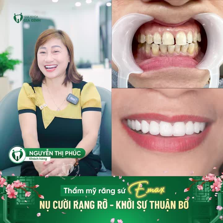 Một năm mới bắt đầu, mọi khởi sự đều trở nên nhẹ nhàng và hanh thông hơn khi ta tự tin với chính nụ cười của mình.
