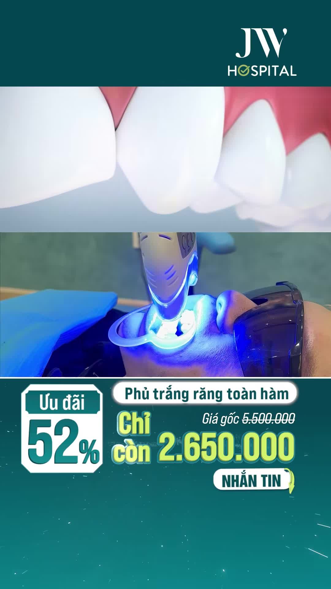 JW GIẢM SỐC 52% XOÁ Ố VÀNG SÁNG BẬT 3 TONE CHỈ SAU 1 LẦN PHỦ TRẮNG RĂNG TOÀN HÀM