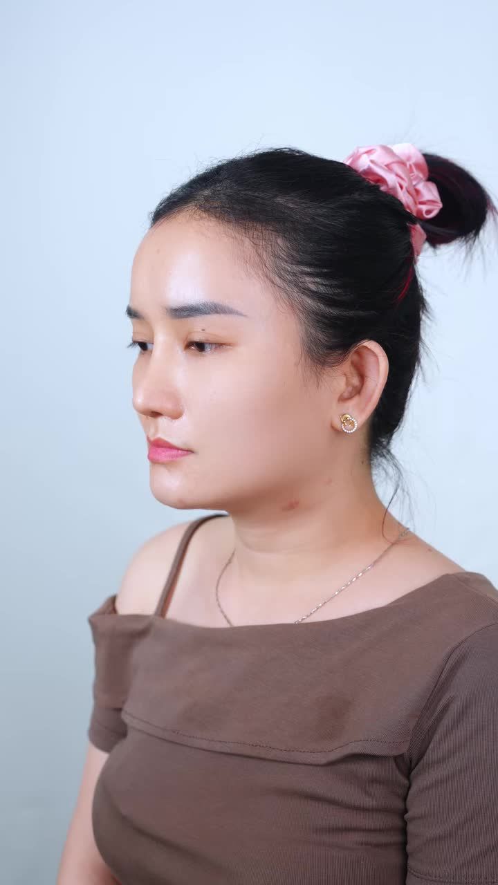 TÁI KHÁM 1 THÁNG NÂNG MŨI: CỰC PHẨM DÁNG MŨI TỰ NHIÊN ĐẾN MỨC KHÔNG AI NHẬN RA!