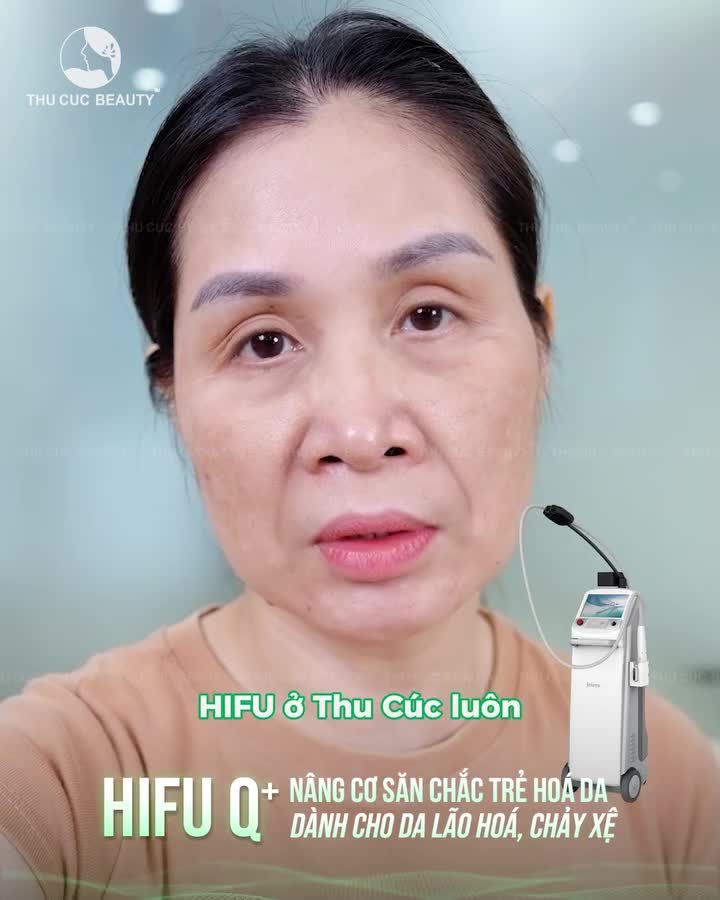 Nếu chị em đang tìm kiếm một giải pháp trẻ hóa dành cho da lão hoá, chảy xệ nhưng lại ngại xâm lấn, thì đây chính là "cứu tinh"!