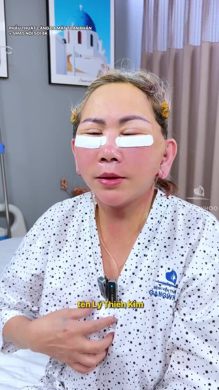 Cả nhà giới thiệu đến BVTM Gangwhoo làm đẹp chị Việt Kiều NaUy bất ngờ với kết quả sau 1 ngày phẫu thuật căng da mặt toàn phần + Smas nội soi 4K
