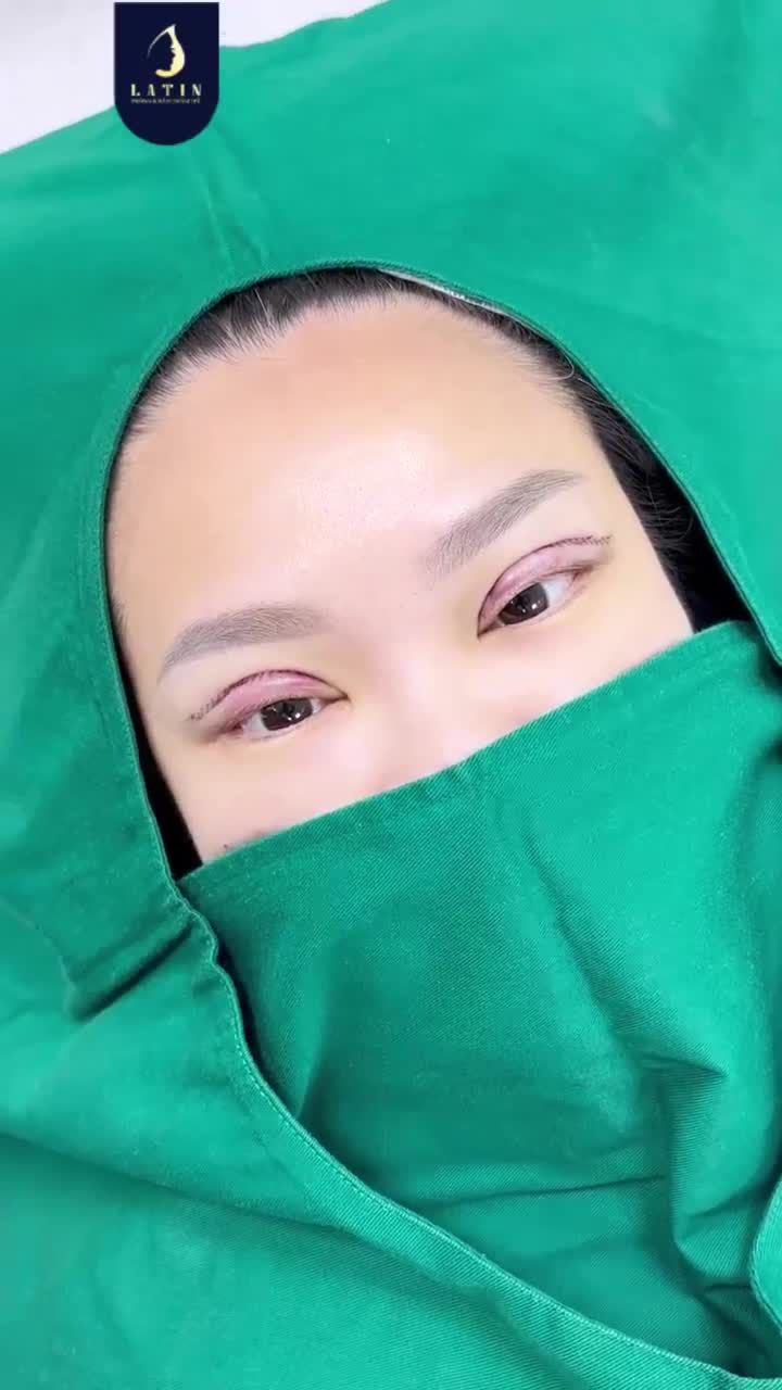 TÂN TRANG ĐÔI MẮT CHO KHÁCH HÀNG TỪ ÚC VỀ