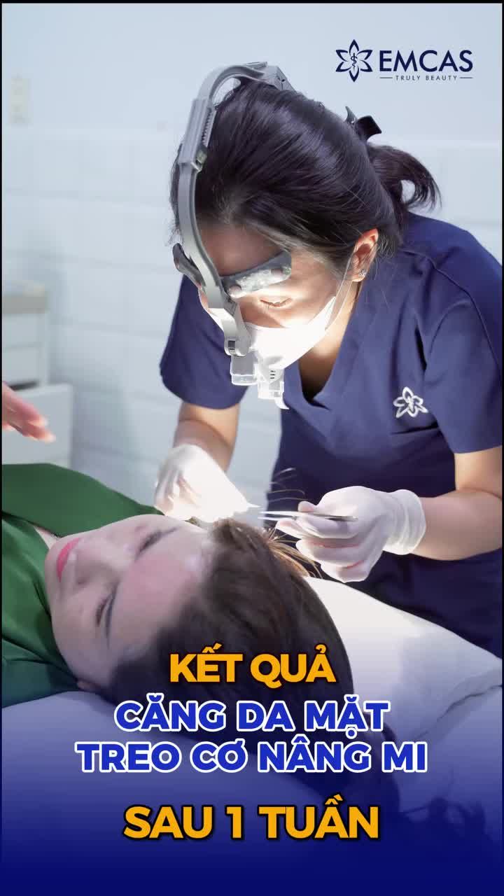 Căng da mặt Căng cơ mặt xử lý tầng nông SMAS và tầng sâu Deep Plane